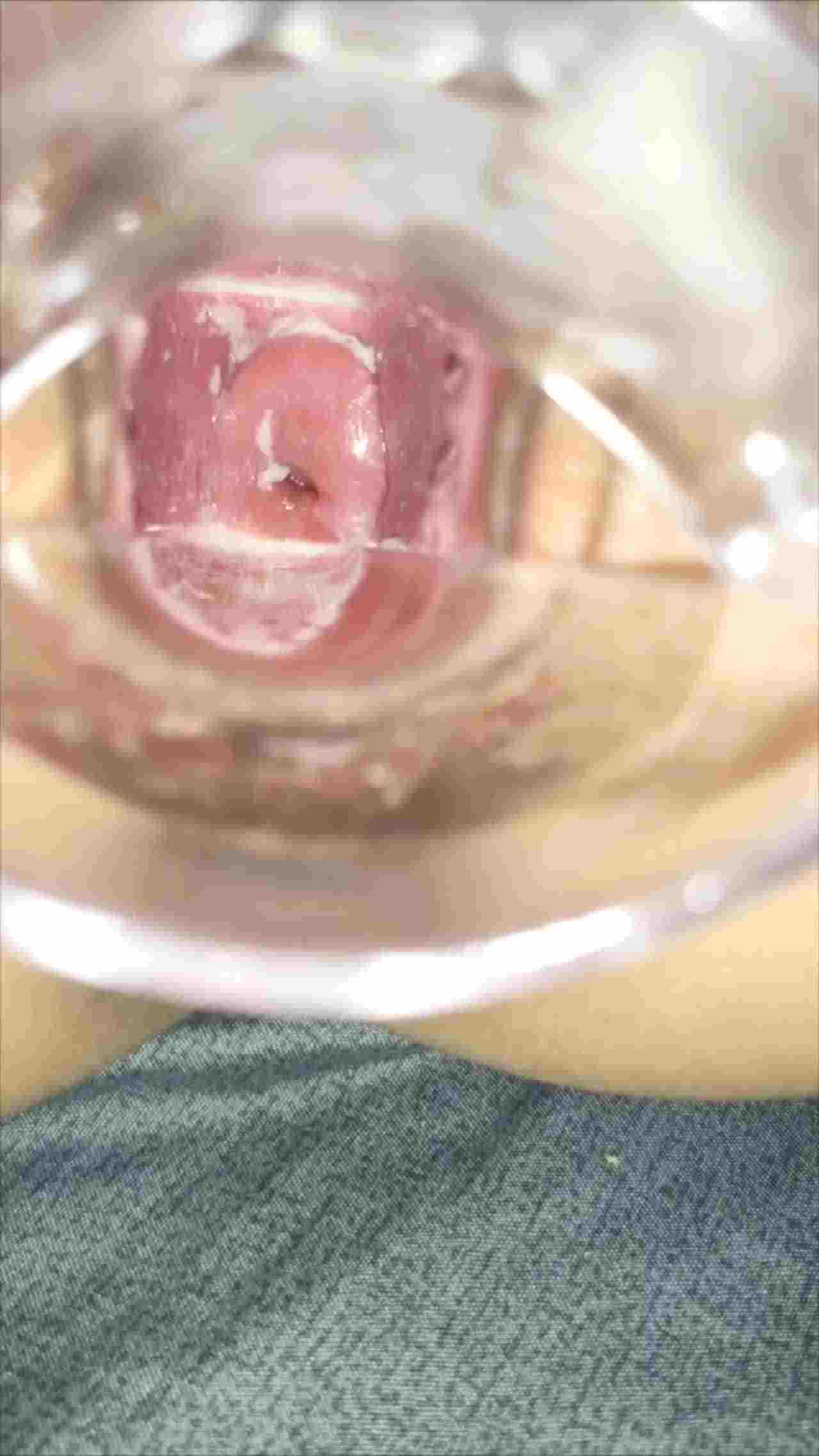  超级可爱的 清纯大学校花 用扩阴器插里面，近距离看小穴里面 的剧照5