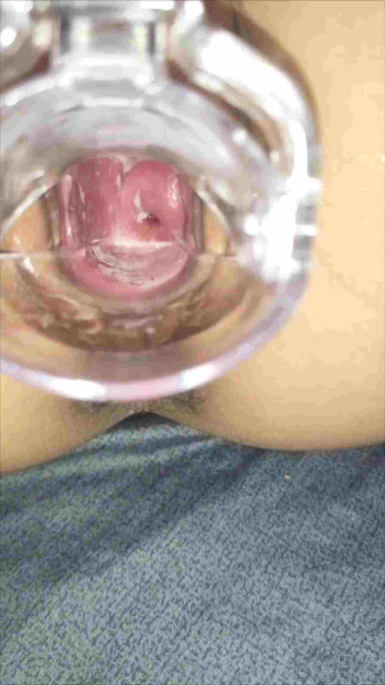  超级可爱的 清纯大学校花 用扩阴器插里面，近距离看小穴里面 的剧照8